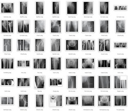 thumbnails of X-rays