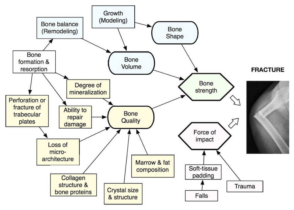 flow diagram about causes of fractures