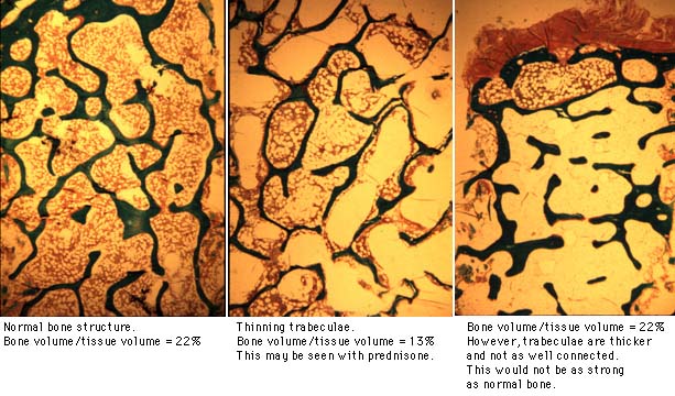 photomicrograph of structure