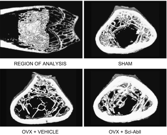 xrays