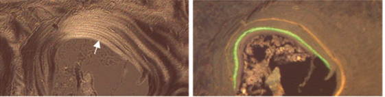 photomicrograph of lamellar bone