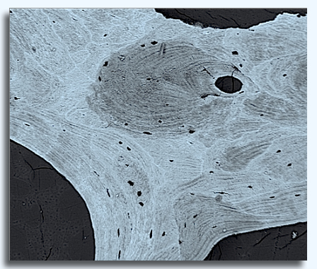 backscattered electron image of bone