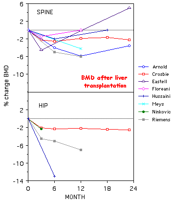 Graph of bone loss in liver transplant patients