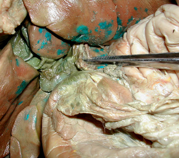 hepatic-artery-bile.jpg