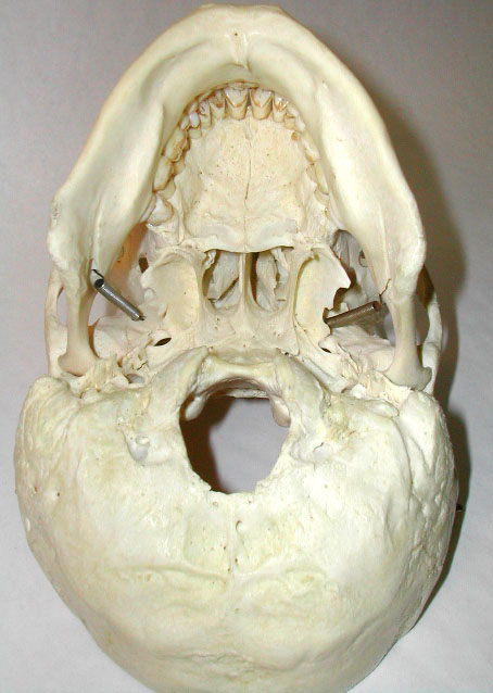 human skull front. Do you have a model skull?