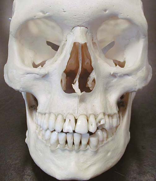 Biology 453 - Specialized Teeth & Skull Images