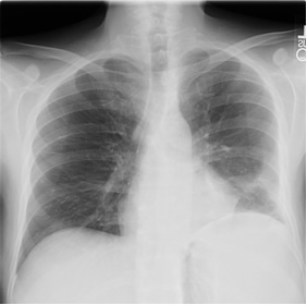 chest x-ray