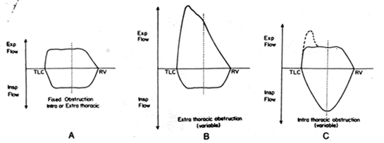 3 patterns of flow volume loop