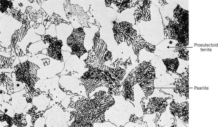 coarse pearlite microstructure