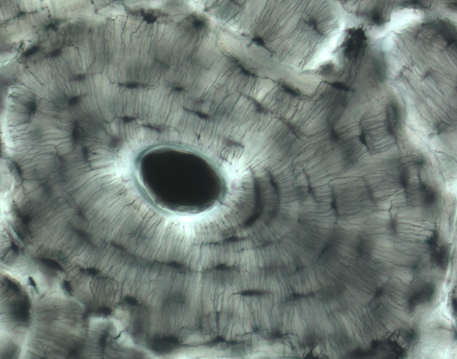 osteon at high magnification