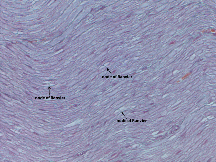 longitudinal nerve with nodes of
      Ranvier