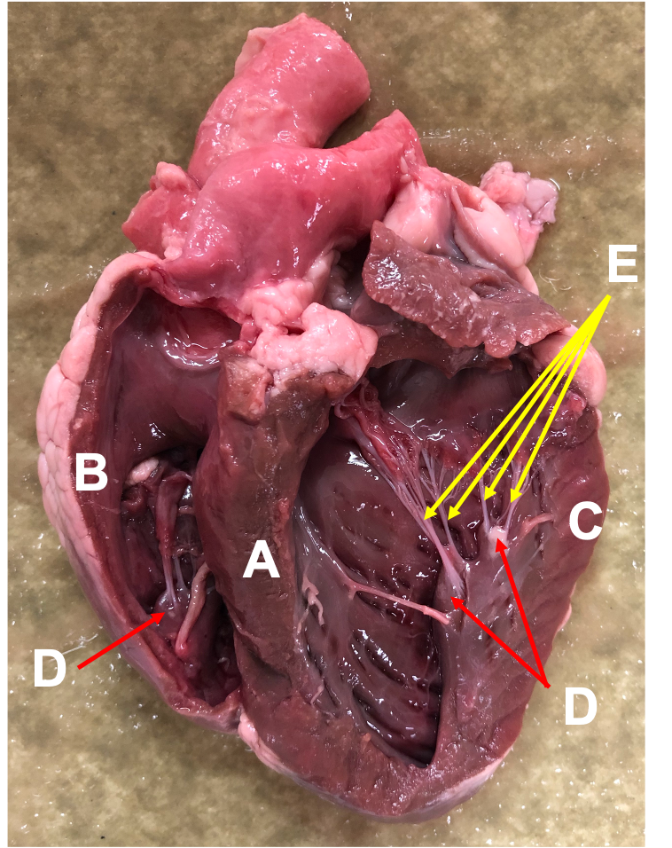 sectional view of heart
