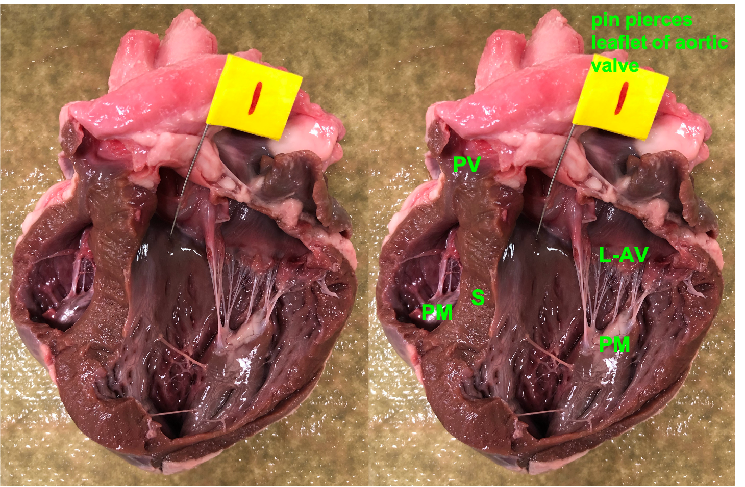 labeled and unlabeled
        hearts showing aortic, pulmonary, and mitral valves