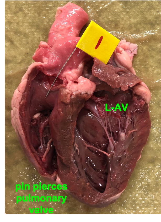 heart labeled for valves