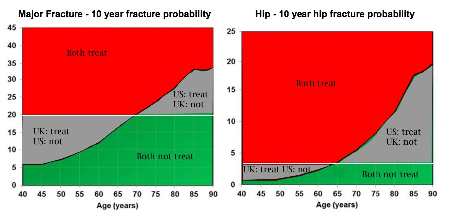 Osteoporosis Score Chart
