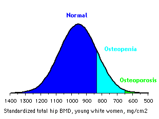 Graph of BMD distribution in young women