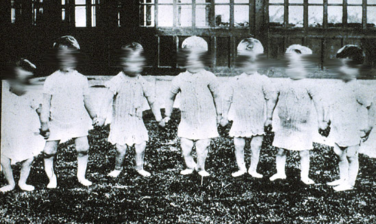 photograph of children with rickets