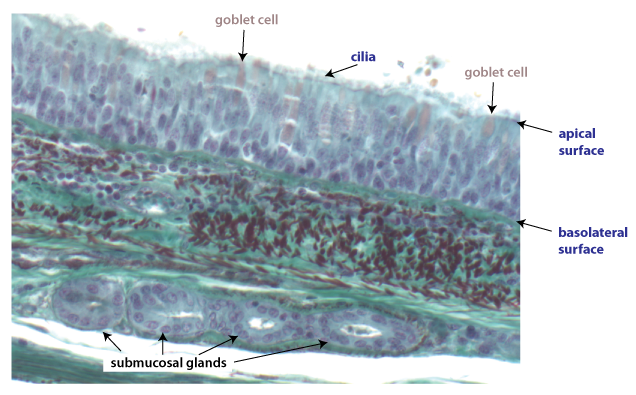 airway epithelium